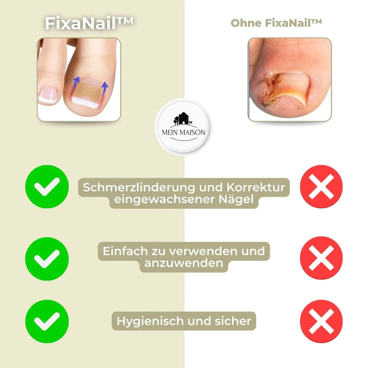 Ingrown Toenail Patches Elastic Peel-and-Stick Set of 20
