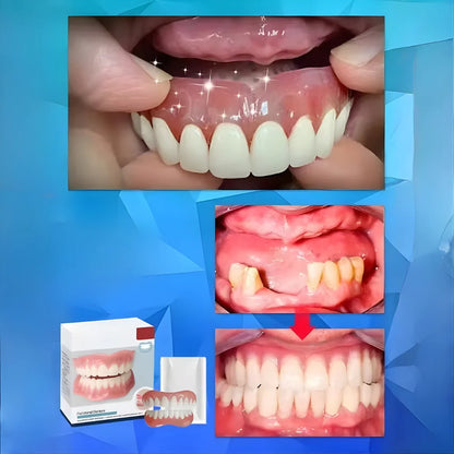 Cosmetic Denture Set Moldable Removable Upper & Lower