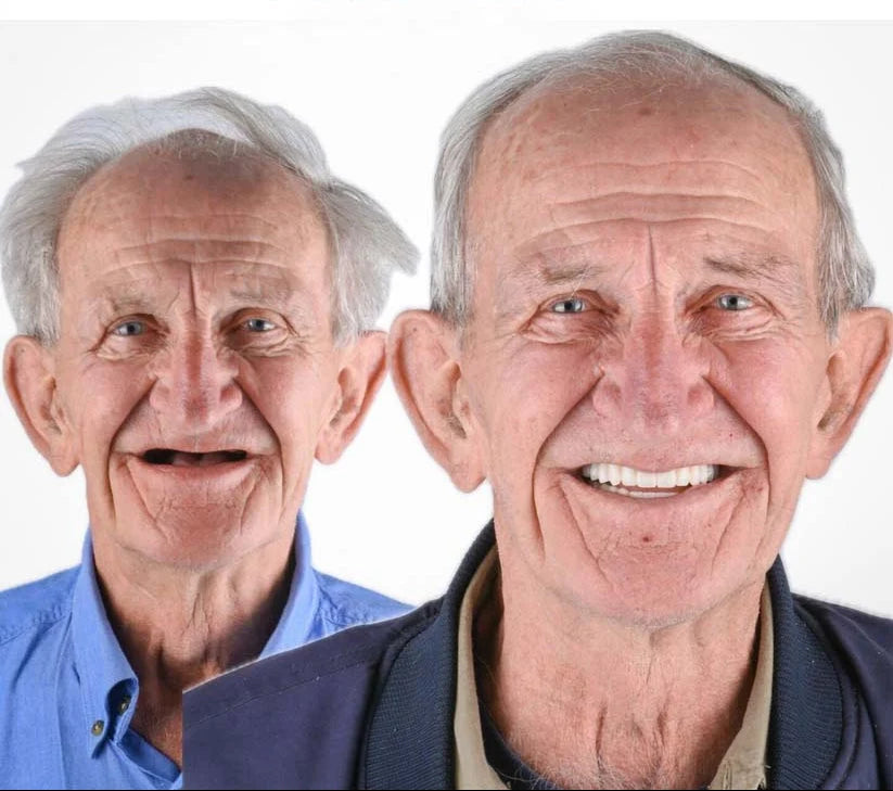 Denture Kit Upper & Lower Adaptive Gel Fit