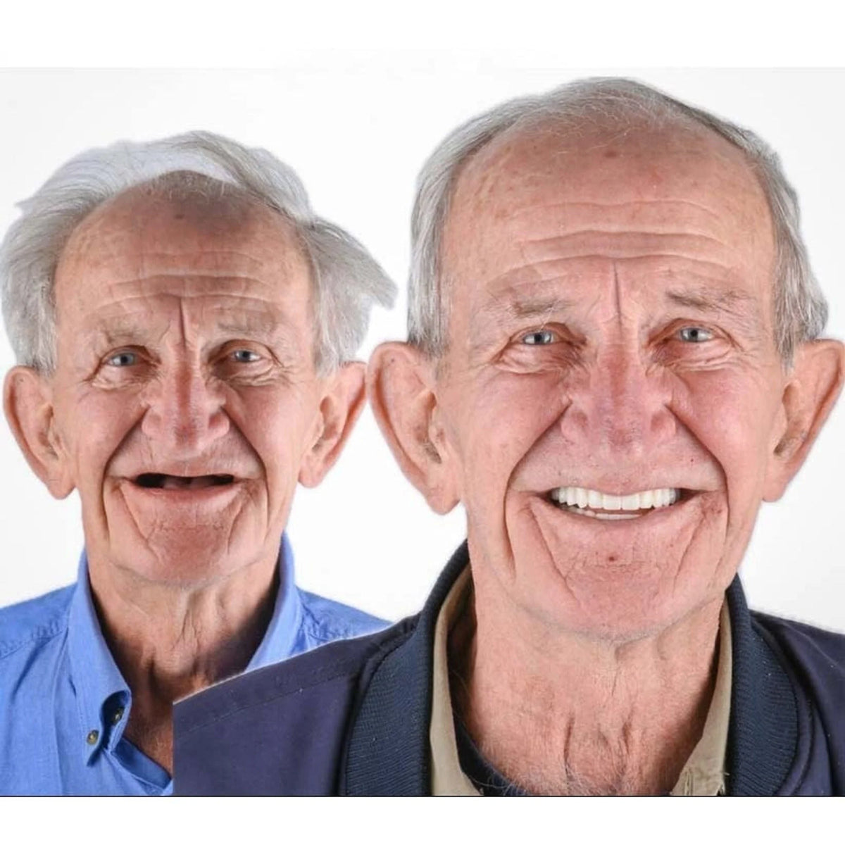 Denture Set Flexible Cushion Grip Upper & Lower