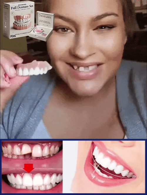 Denture Set Heat-Moldable Upper and Lower Jaw Reusable