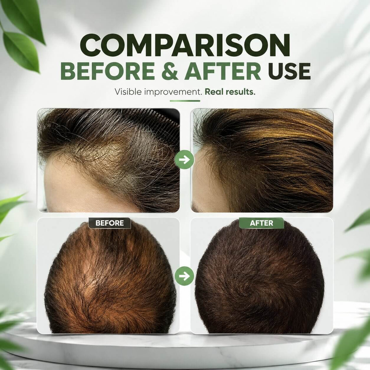 Hair Growth Oil Rosemary Lightweight Scalp-Nourishing
