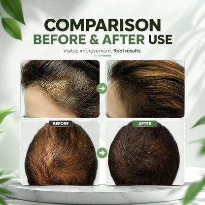 Hair Growth Oil Rosemary Lightweight Scalp-Nourishing