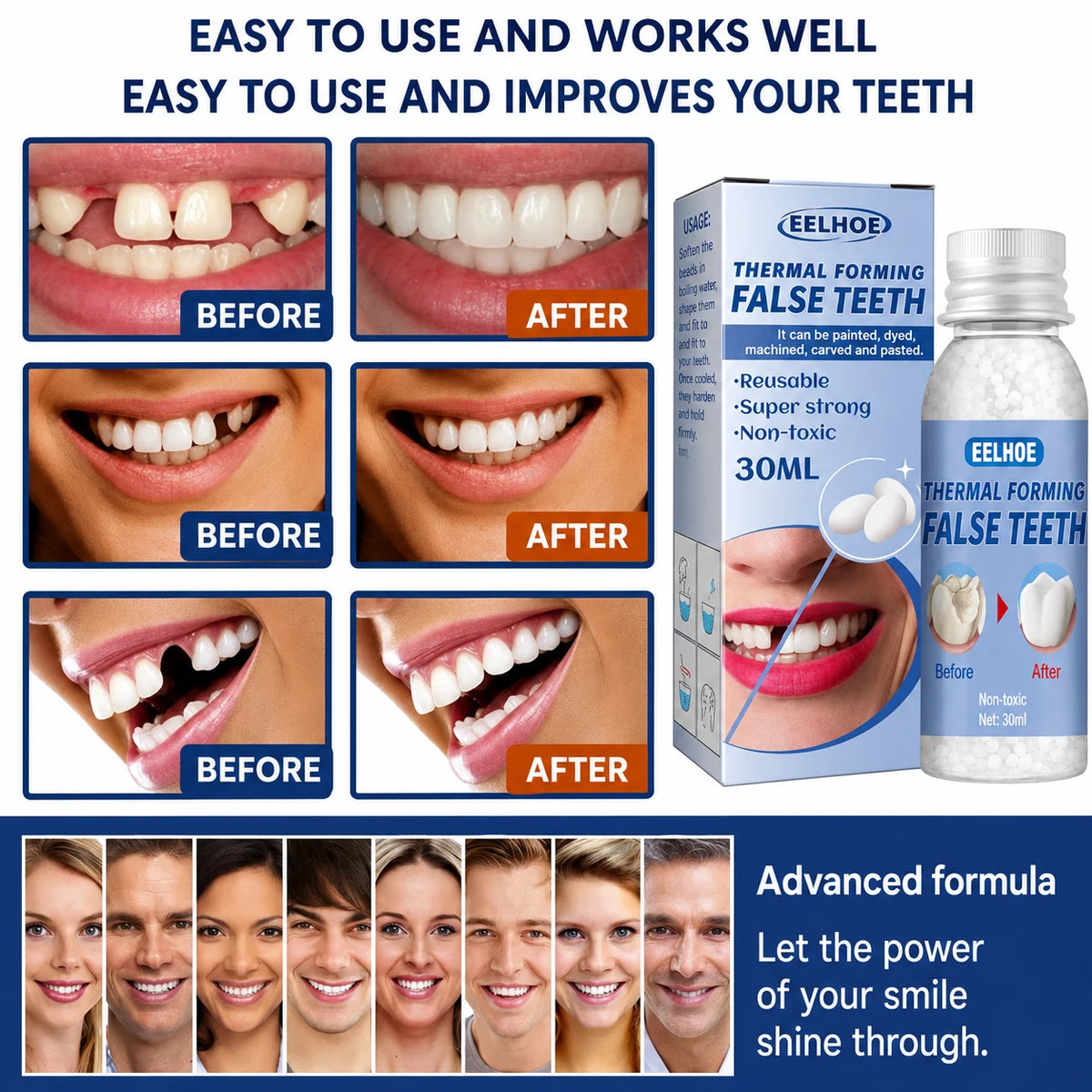 Instant Smile Repair Kit | Close Gaps & Amplify Confidence