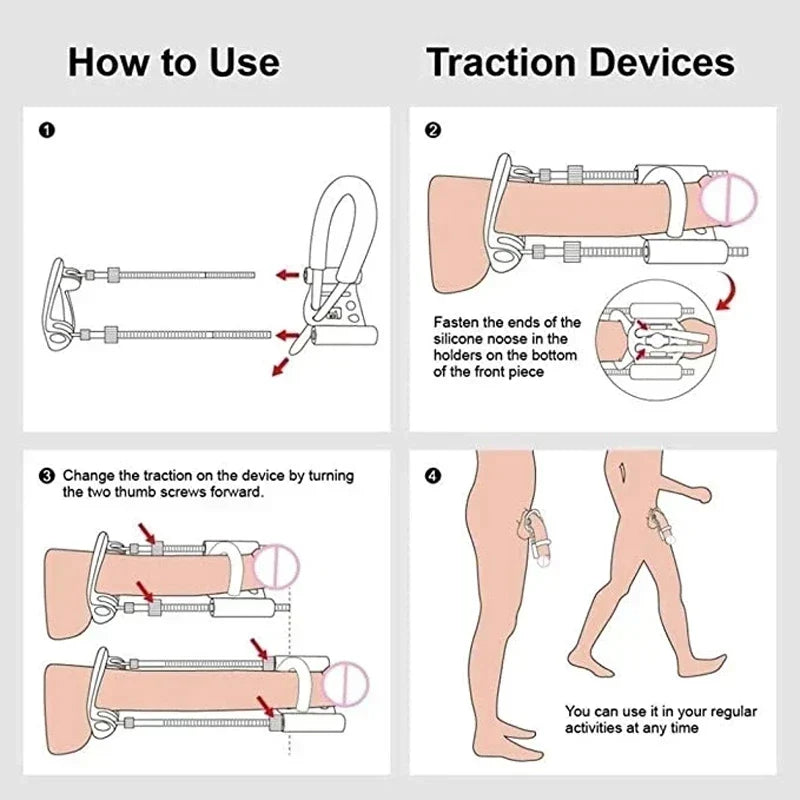 Penile Traction Device Adjustable Tension Stainless Steel Frame
