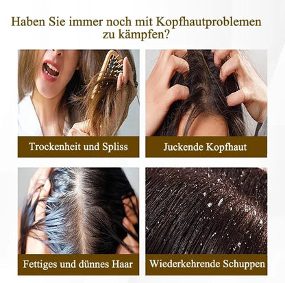 Scalp Massage Comb Hollow Bristles Dandruff Remover