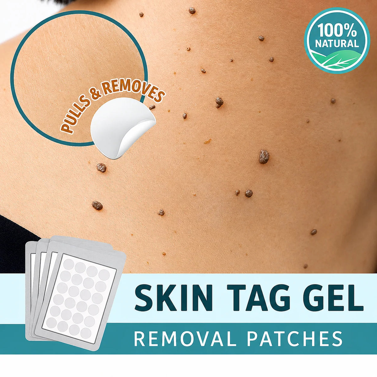 Skin Tag Remover Patches Gentle Non-Invasive Application